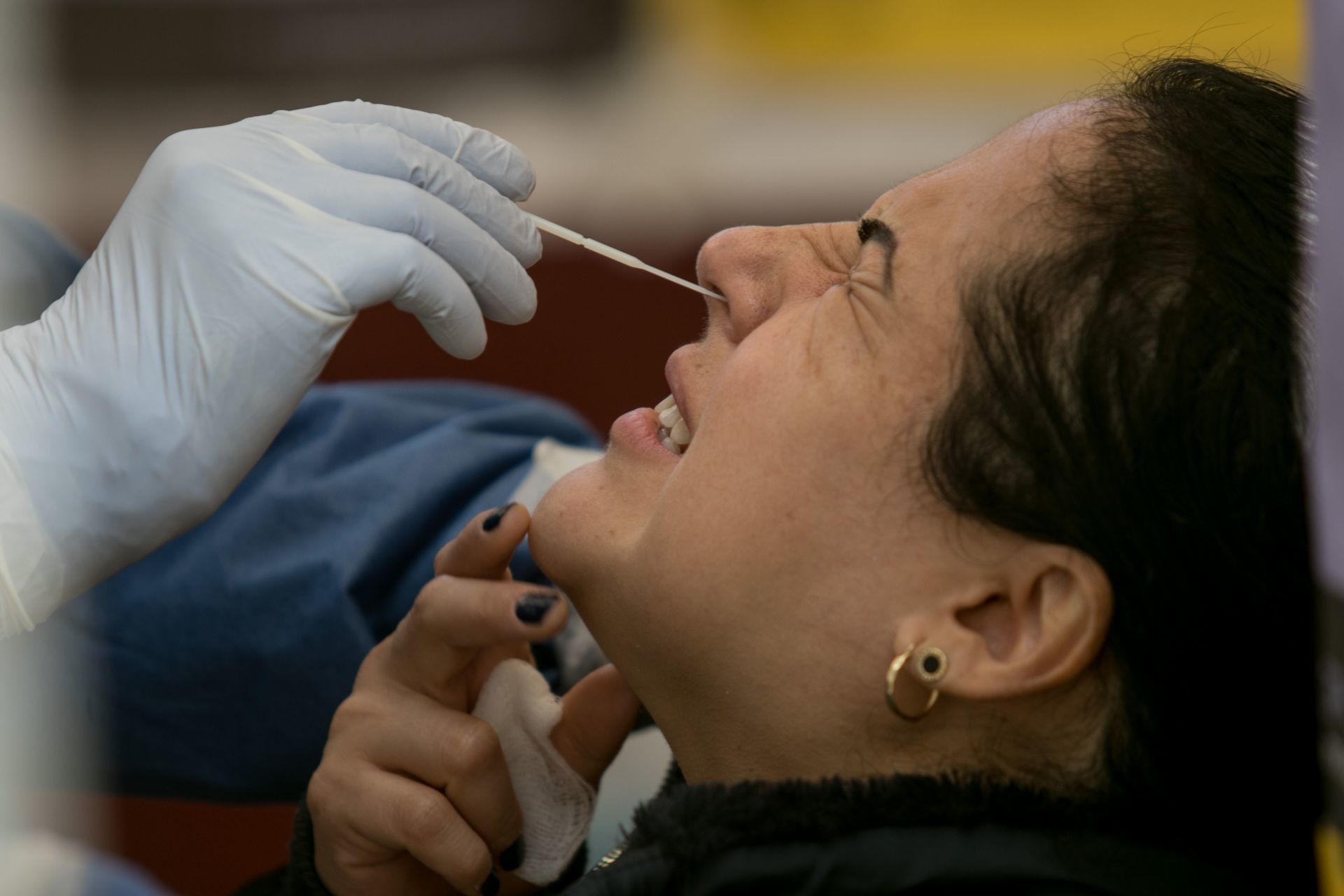 OLOV: Mujer presenta derrame de líquido craneal luego de realizarse prueba de COVID-19